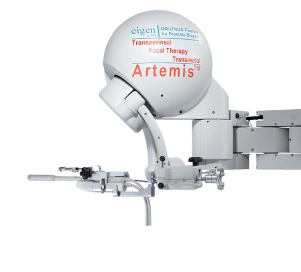 Artemis Fusionsbiopsie System